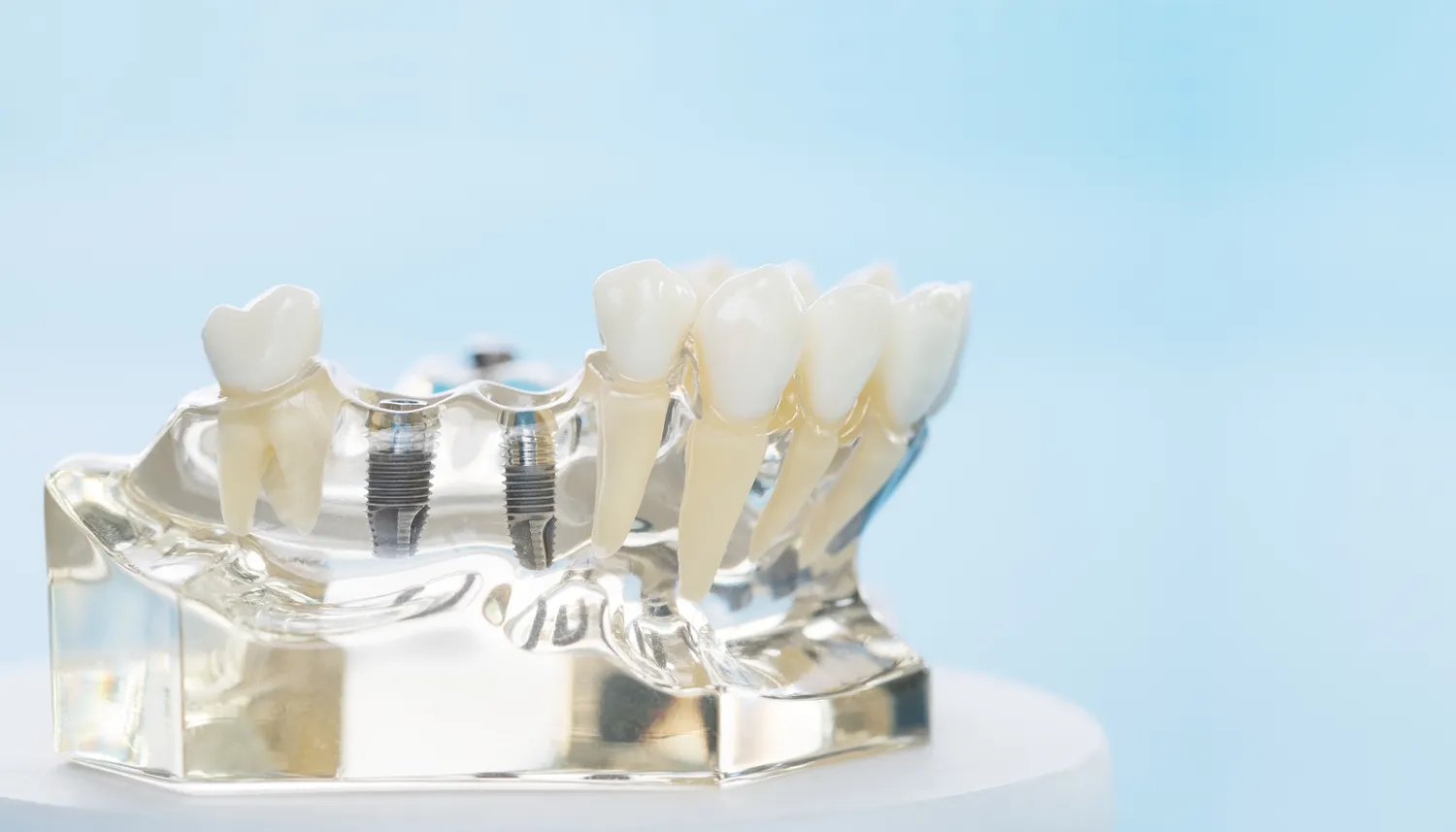 Najlepszy dentysta Szczecin