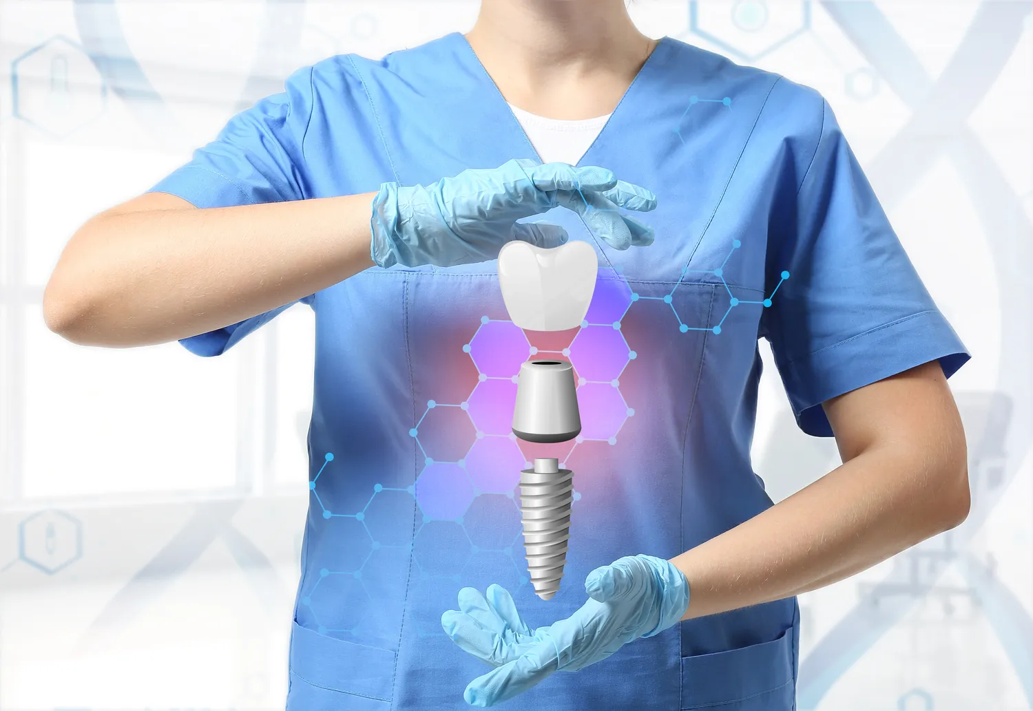 Co należy wiedzieć przed wyborem implantu zęba?