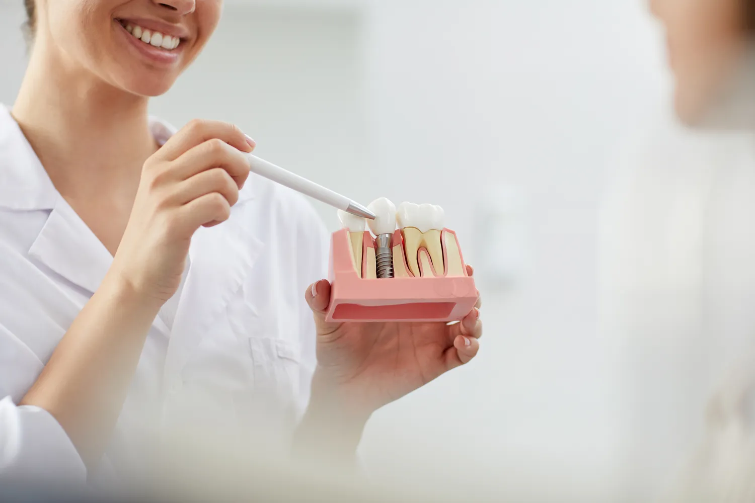 Rodzaje implantów zębowych