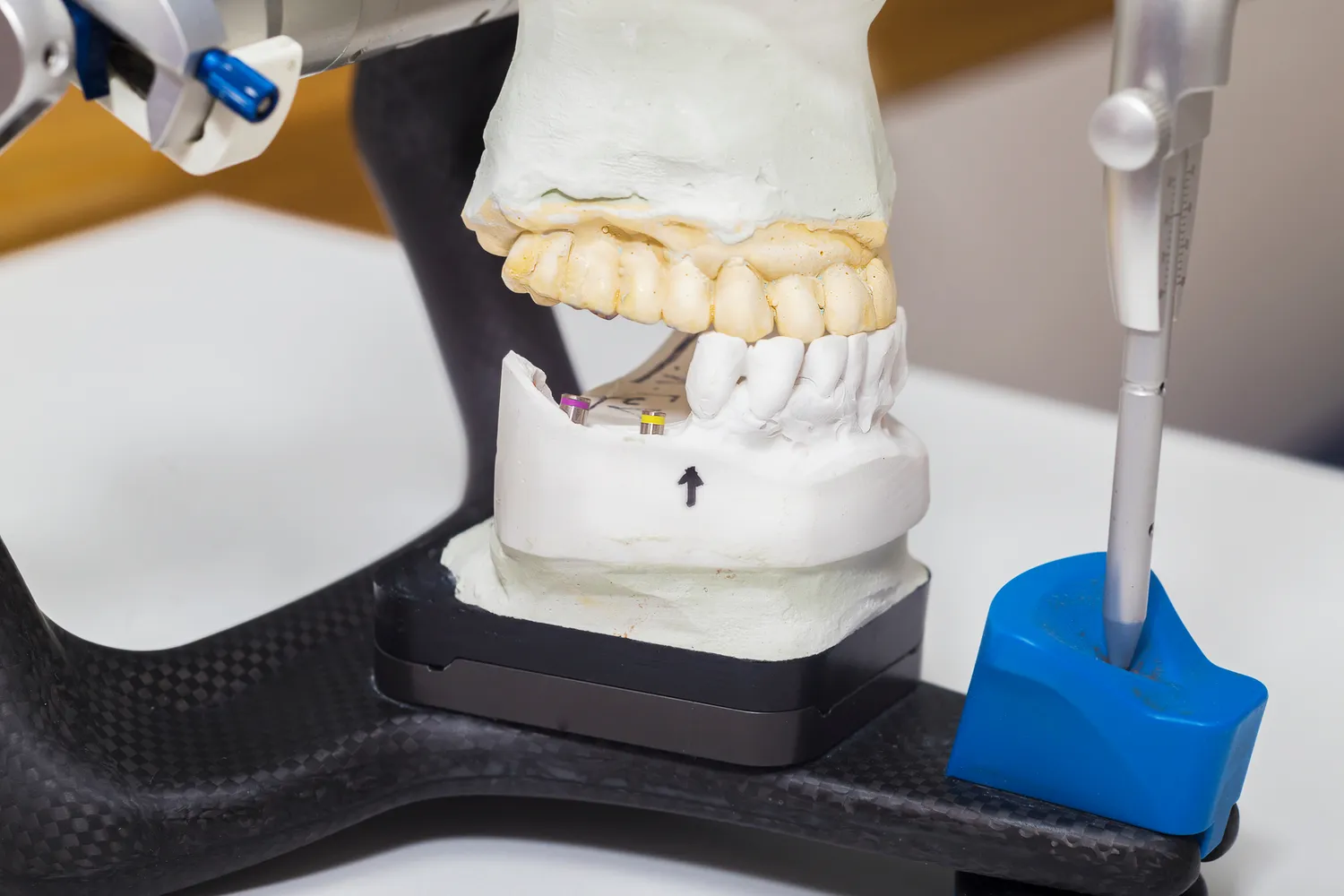 Zabiegi dentystyczne refundowane przez NFZ